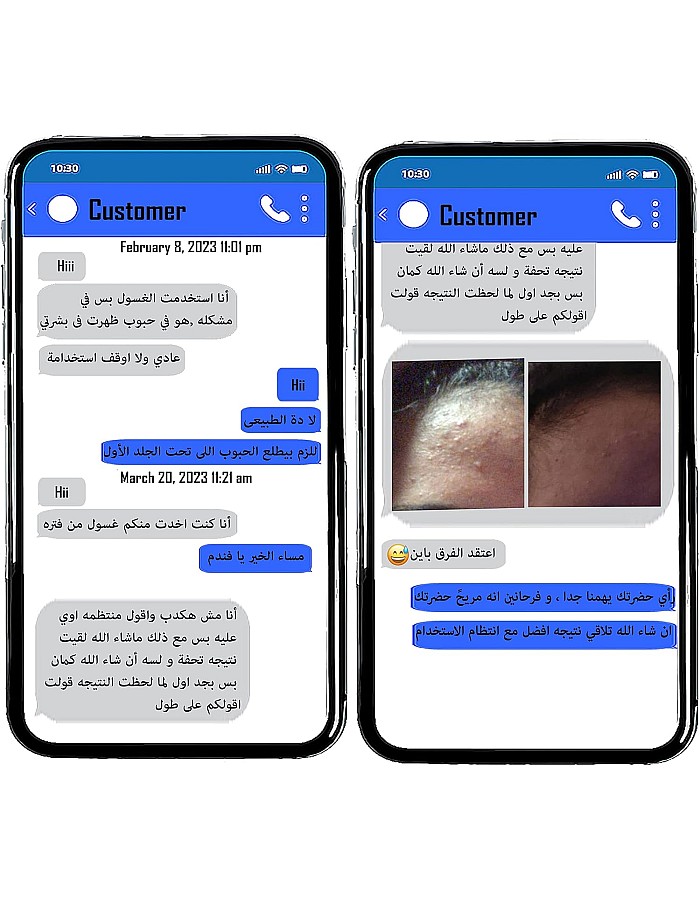 غسول وجه بخلاصة شجرة الشاي للبشرة المعرضة لحب الشباب (طبيعي) (غني بالبانثينول)، من اورجلام