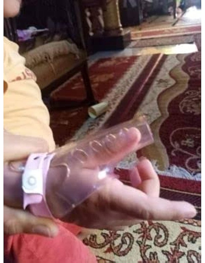 لعلاج مص الإبهام الأطفال مقاس كبير 4 حتى 10 سنوات، أكريلونيتريل بوتادين ستايرين، يستخدم لتصحيح القوام، من نواهيت