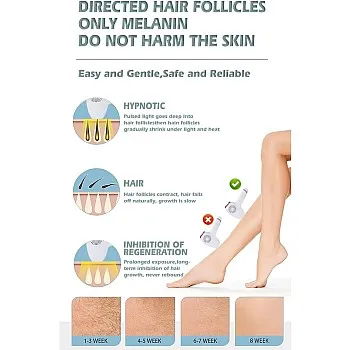 Home Laser Hair Removal with Ice Cooling Technology - 350,000 Flashes - 5 Energy Levels - Efficient and Permanent - (Model 70201) - For Smooth and Hair-free Skin